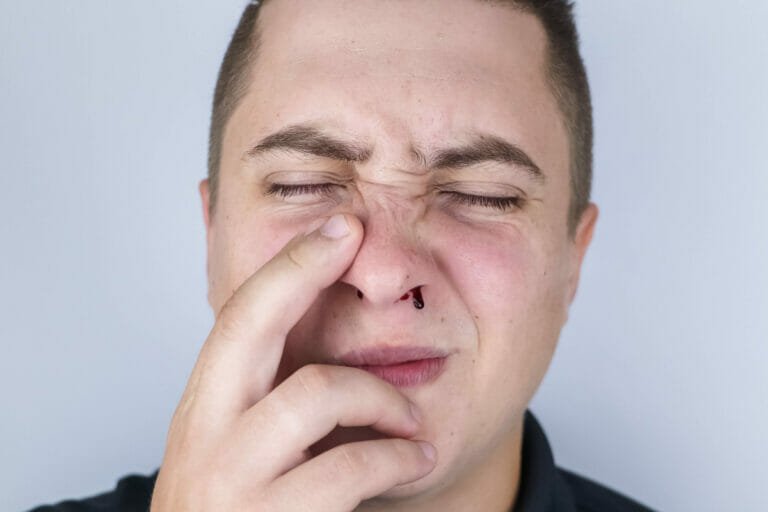 How Do Boxers Stop Nosebleeds?